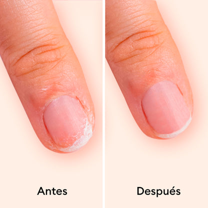 Sérum endurecedor de uñas